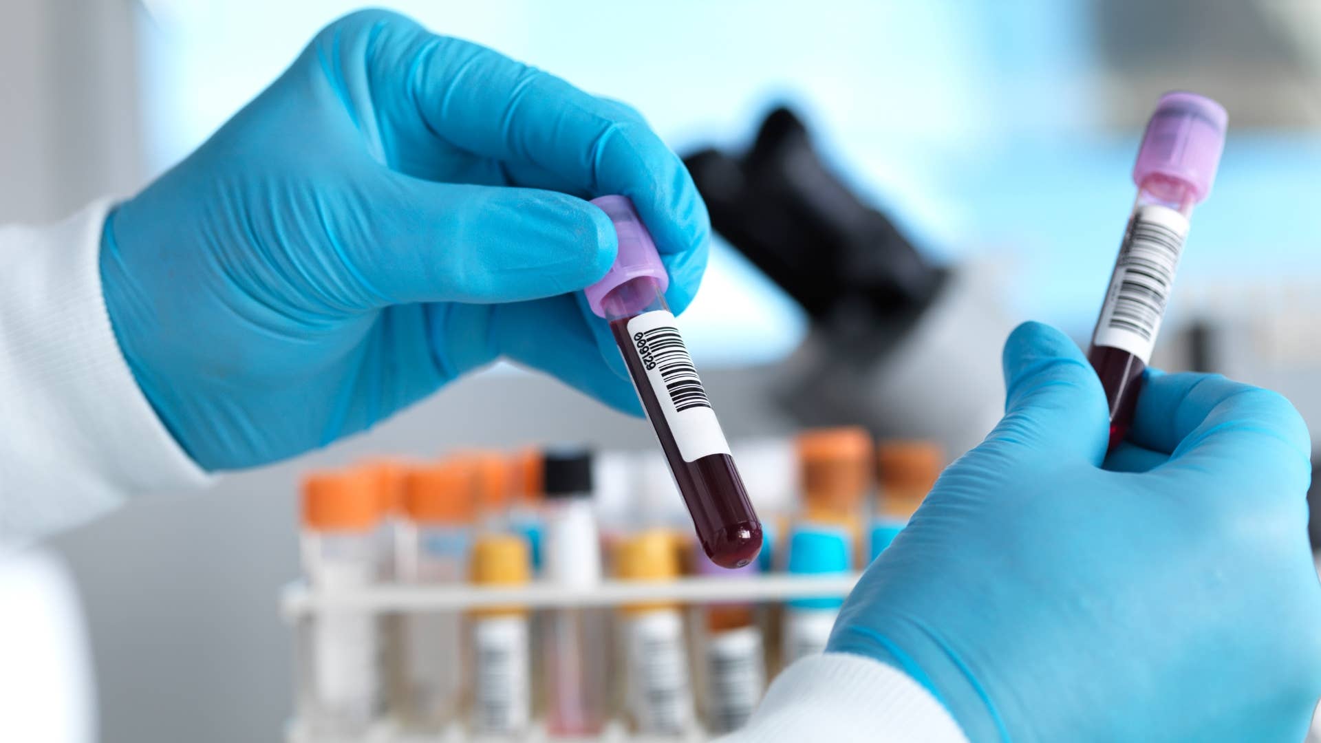 FDA Approves First-Ever Blood Test for Alzheimer's - Men's Journal