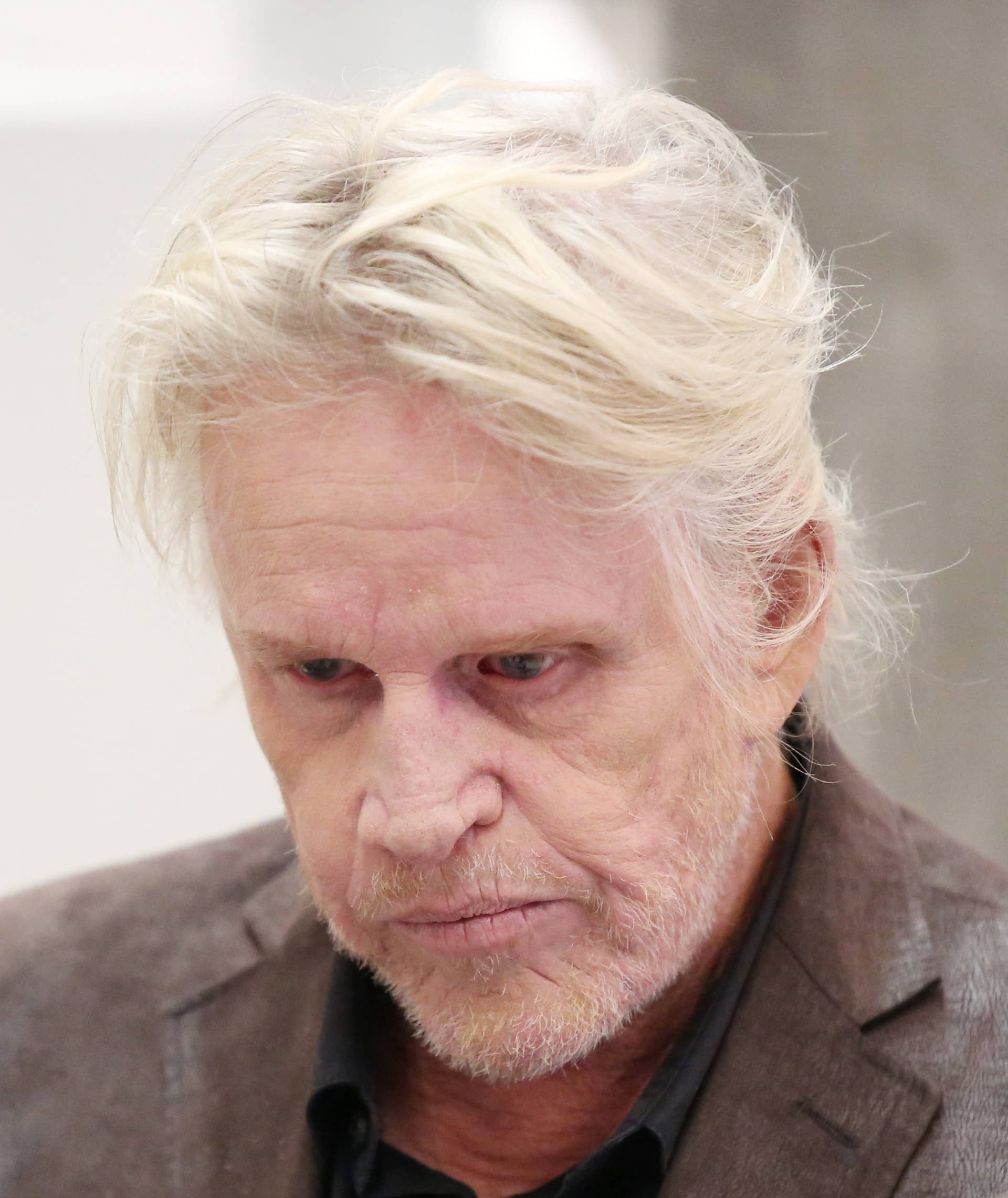 Unrecognizable Gary Busey Pleads Guilty in Shocking Sexual Assault Case
