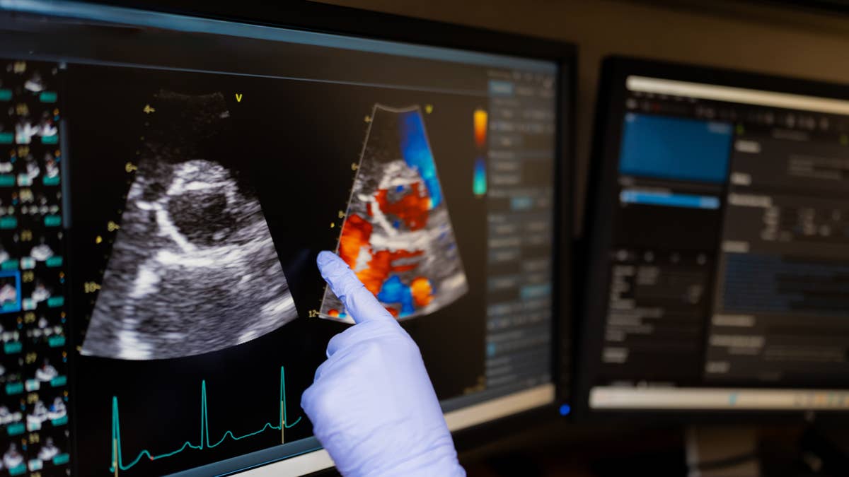Heart Disease Develops Silently for Years. Cardiologist Recommends 4 Preventative Health Tests for Men Over 50