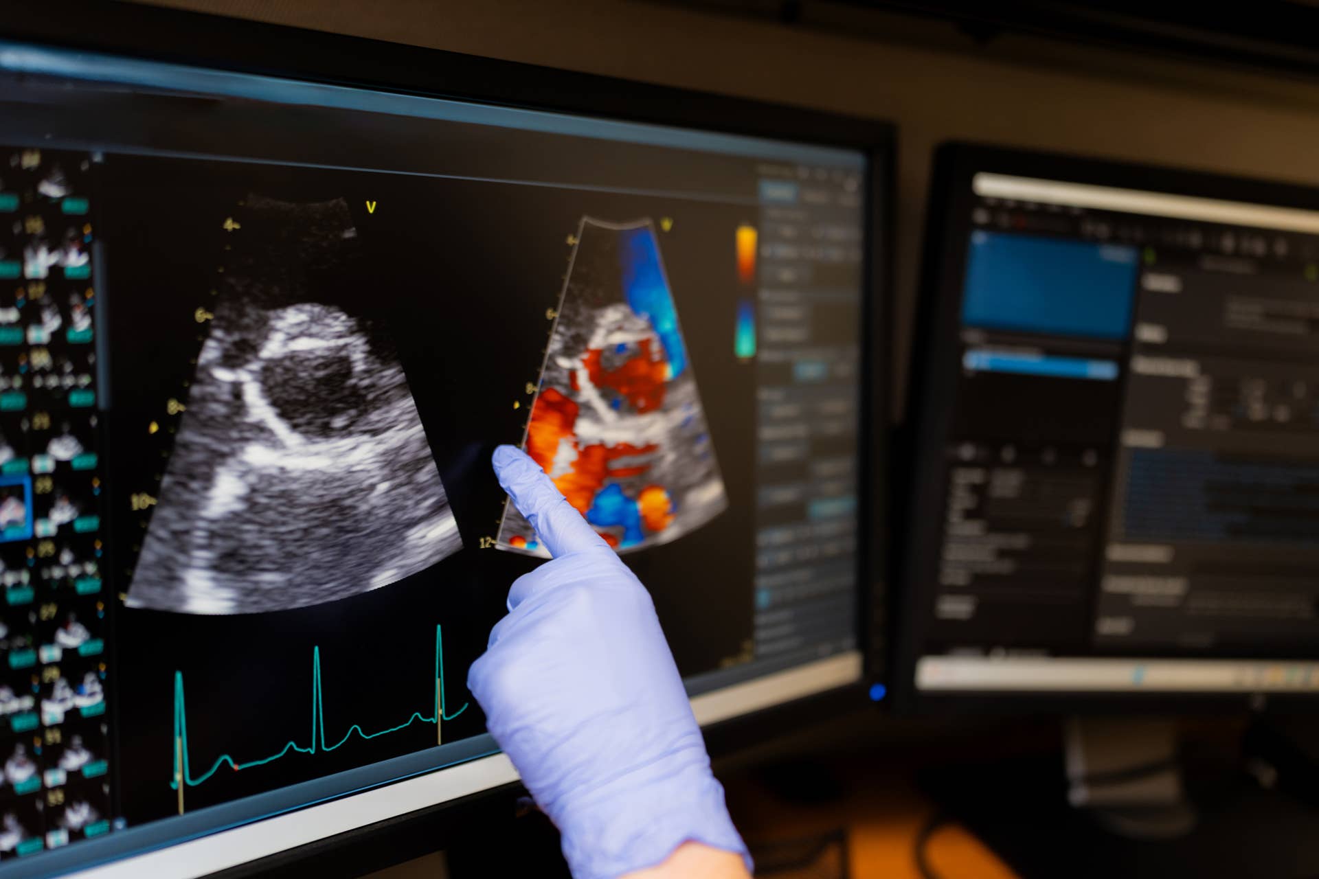 Scientists Found Just 10 Weeks of Exercise Can Change Your Heart's ...