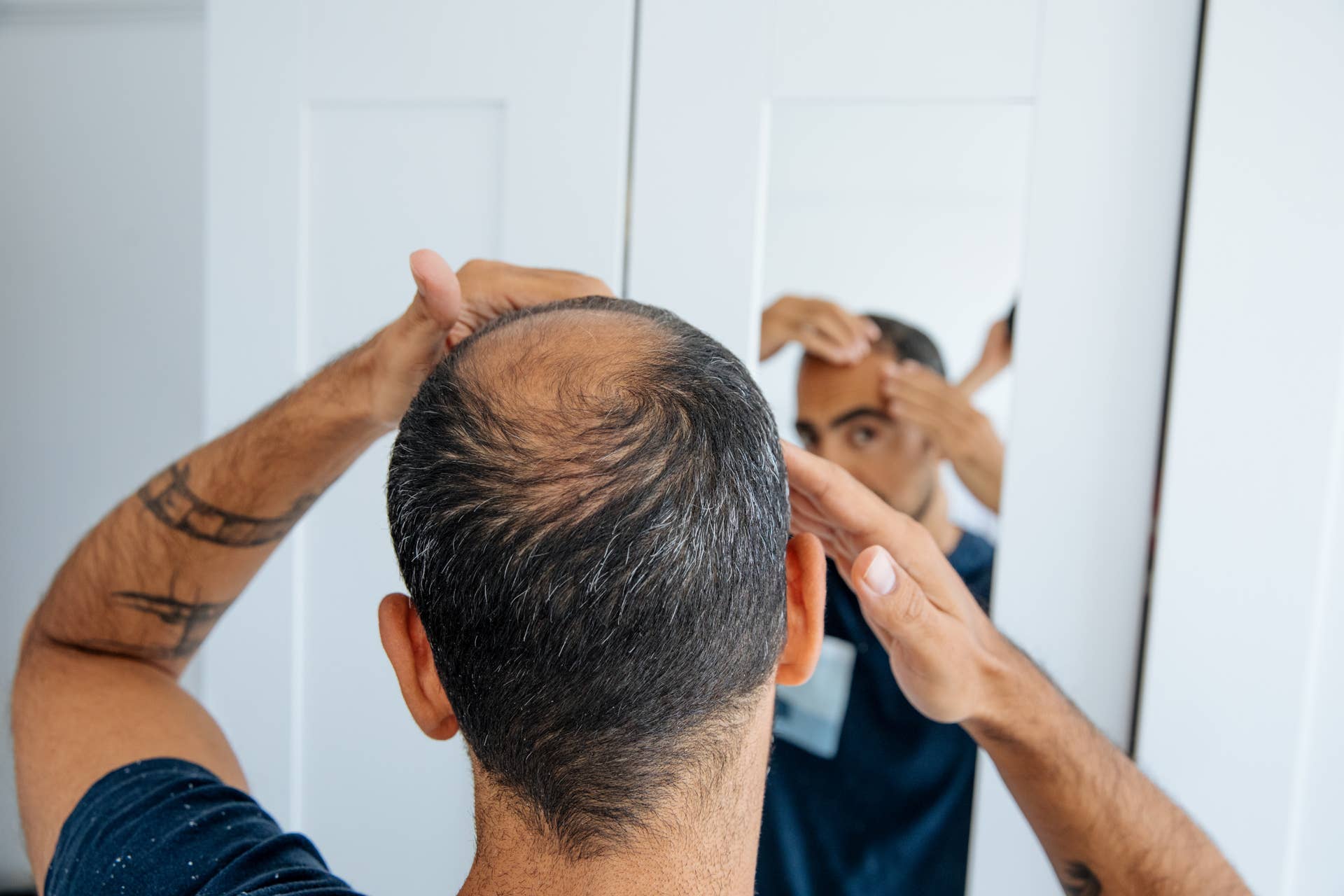 I'm a Hair Restoration Surgeon. These 3 Medical Treatments Can Help Slow Down Hair Loss for Men Over 50