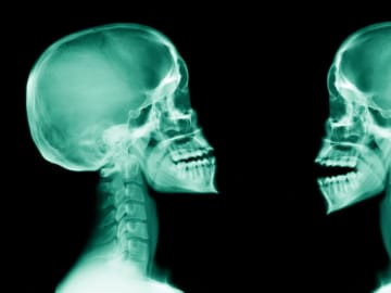 Researchers Reveal Breakthrough in Alzheimer’s Disease and the Shocking Place It Might Originate in Your… 