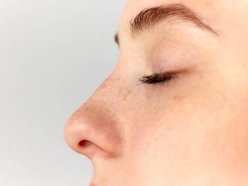How an $11K Nose Job Helped a Woman Finally End Her 