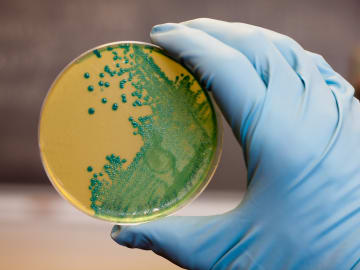 Food Safety Alert: Listeria Concerns Trigger Recall In At Least 15… 