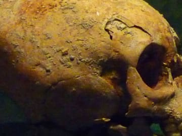 Bizarre Skull Discovery Illuminates Previously Unknown Ancient… 
