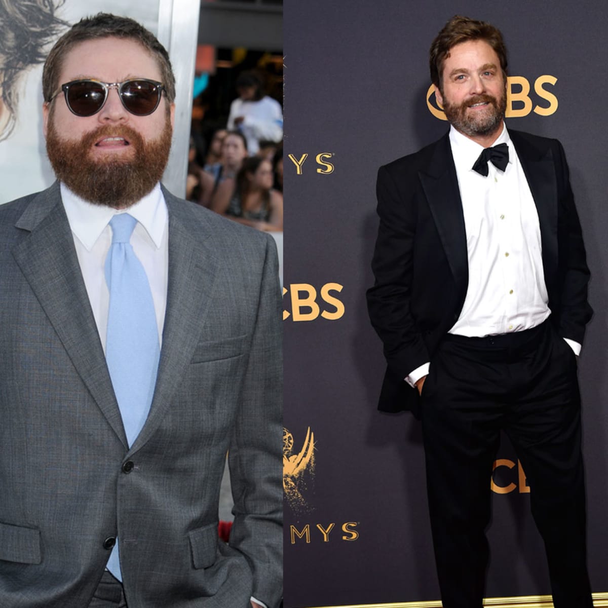 Zach Galifianakis Weight Loss: 11 Photos of the Actor's Lean New Look - Men's Journal