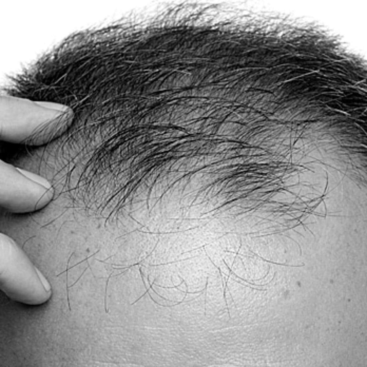 Myths and Facts about Hair Loss - Men's Journal