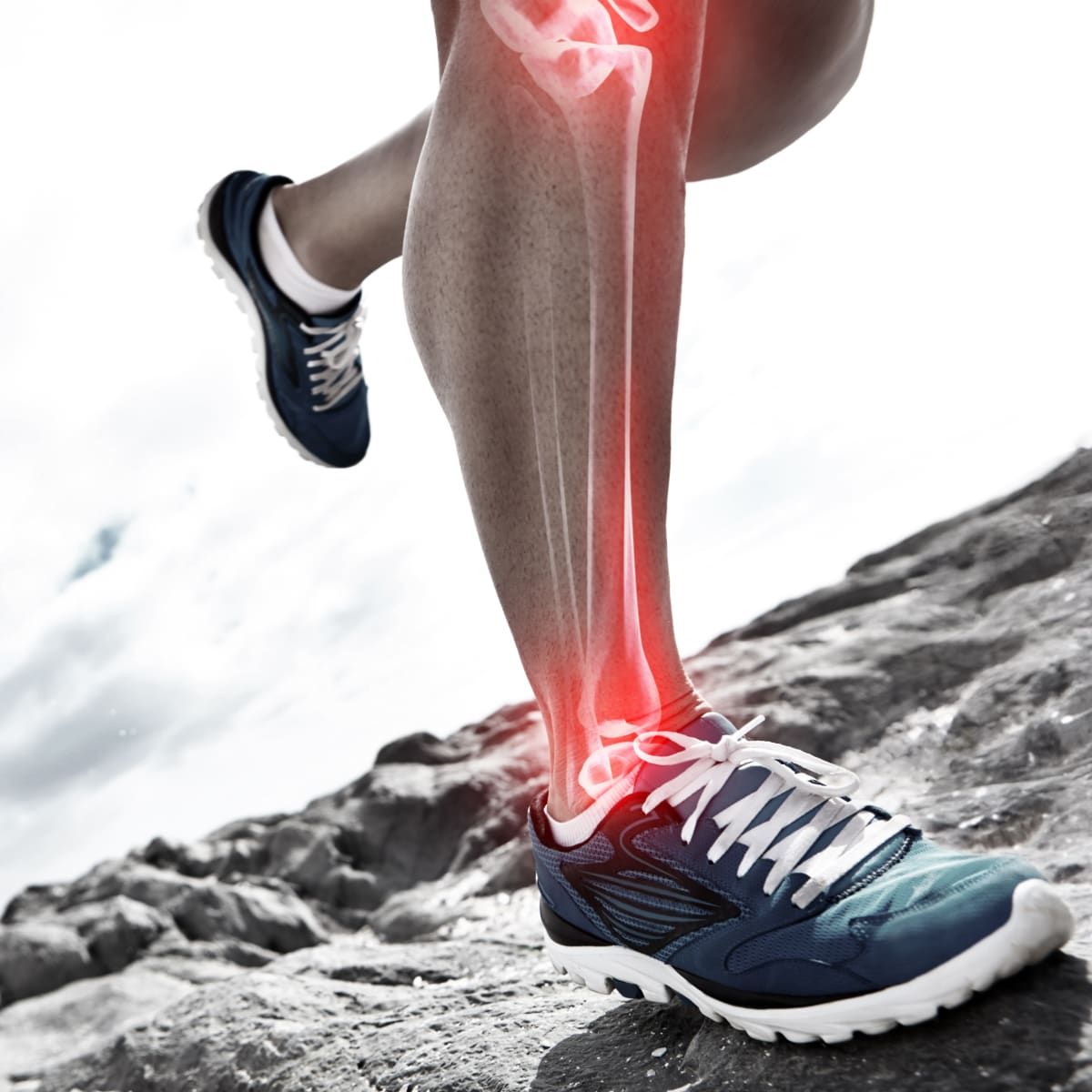Orthopedic shoes deals for supination