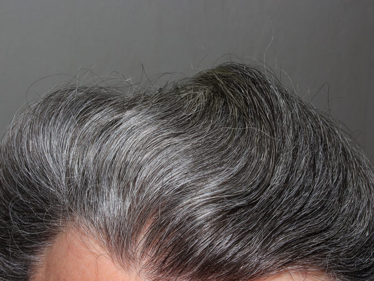 Scientists may have found the root cause of going gray and balding - Men's  Journal