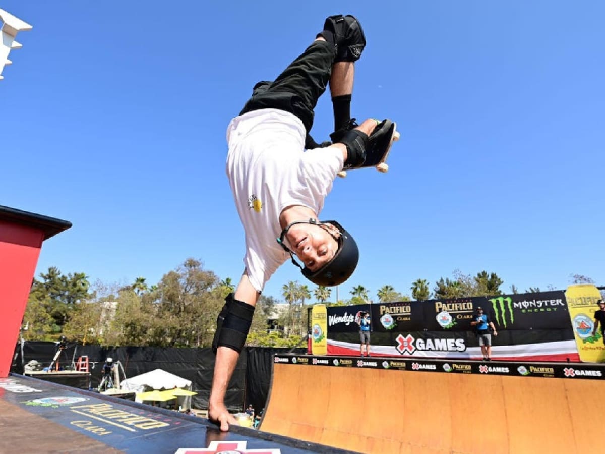 Tony Hawk breaks his leg but isn't retiring