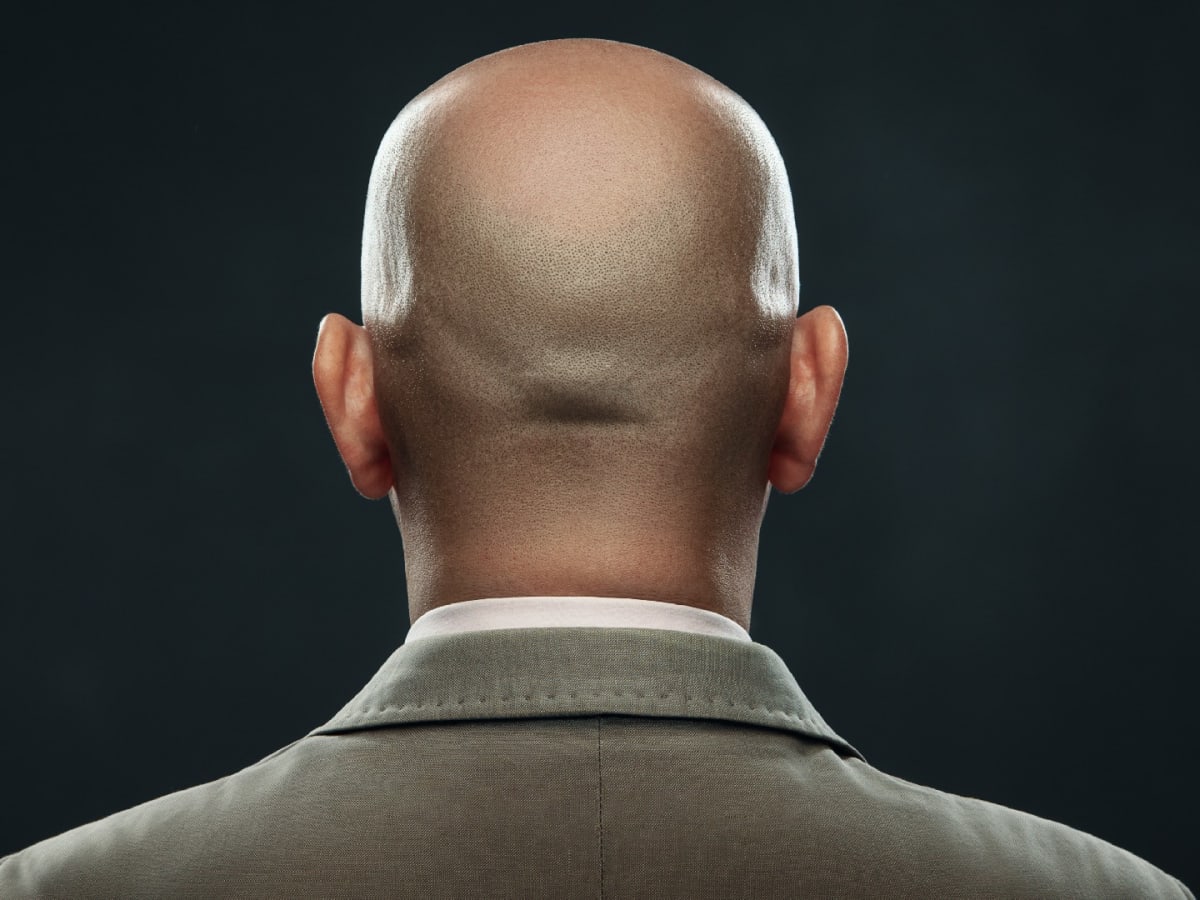 Bald back of head sale