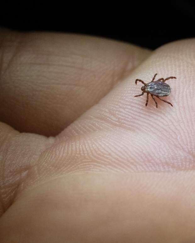 20 February 2024, Baden-Württemberg, Stuttgart: A member of the Parasitology Department at the University of Hohenheim shows a colored tick (Dermacentor reticulatus) in a laboratory. Experts explain the current state of research in an online press release for the South German Tick Congress. As a result of the persistently mild weather, ticks have come through the winter well in this country and are already very active. Photo: Marijan Murat/dpa (Photo by Marijan Murat/picture alliance via Getty Images)