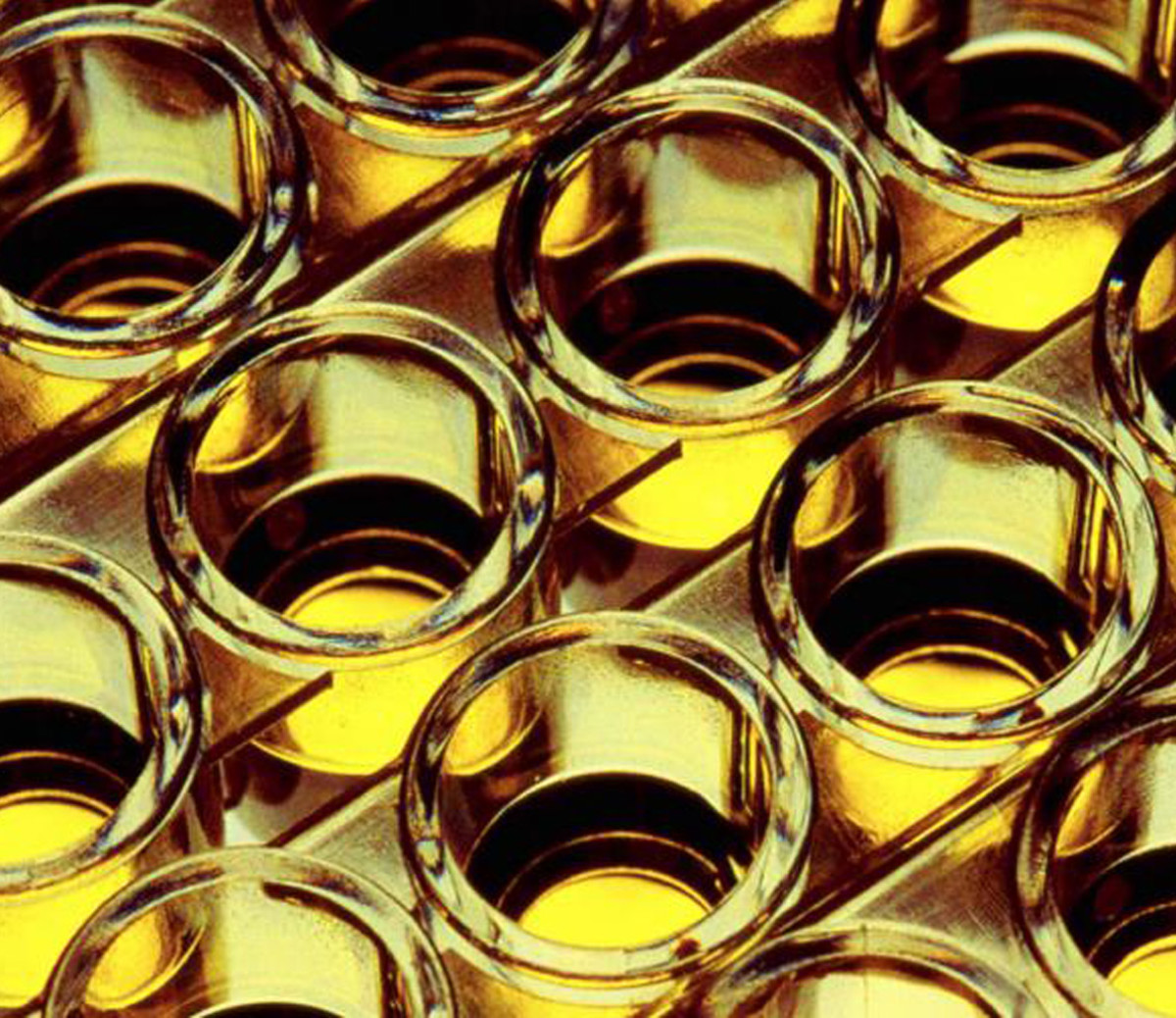 A breakthrough test can gauge your health, using only your pee Men's