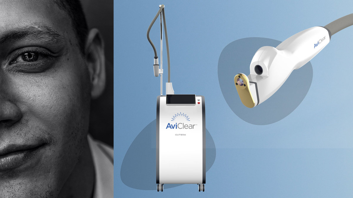 AviClear Review This Acne Laser Treatment Rivals Accutane Men's Journal
