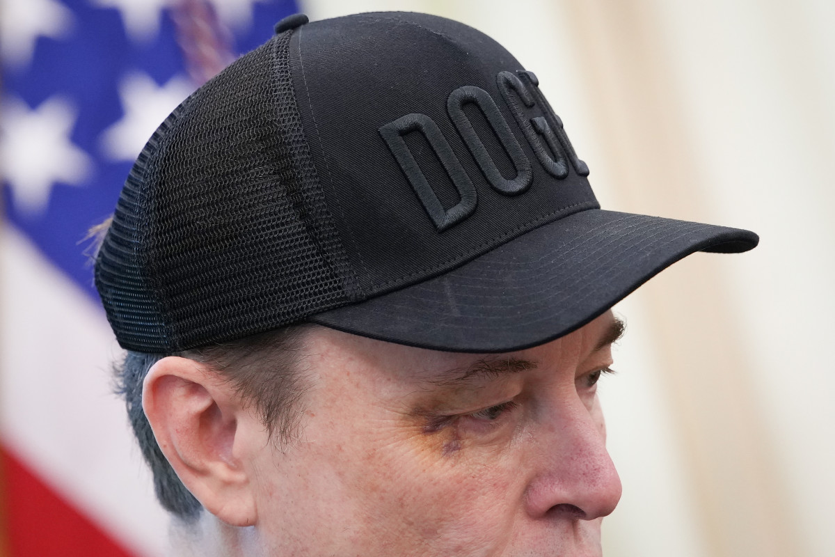 Elon Musk Shows Up With Black Eye to Major Event