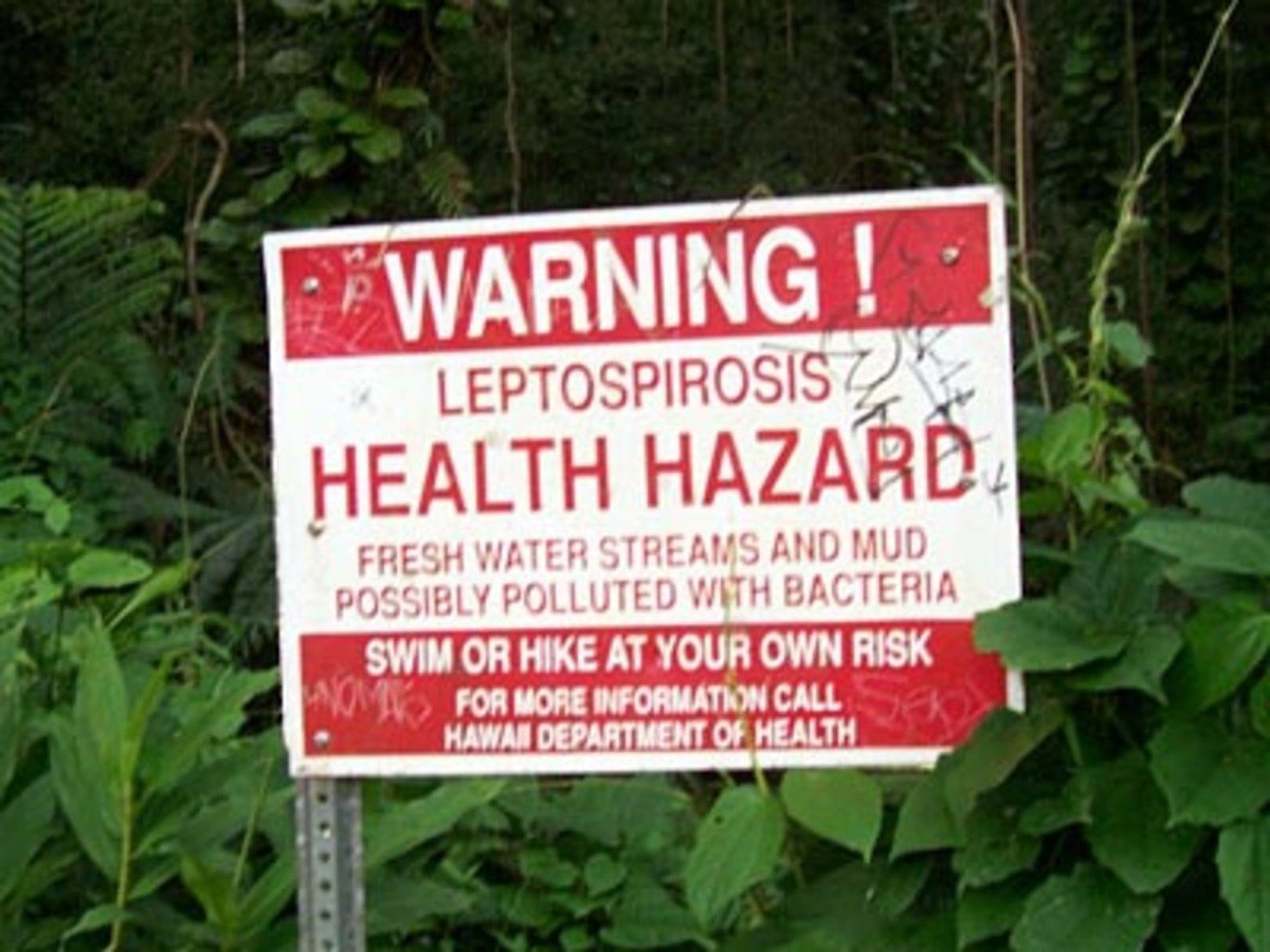 leptospirosis-sign leptospirosis