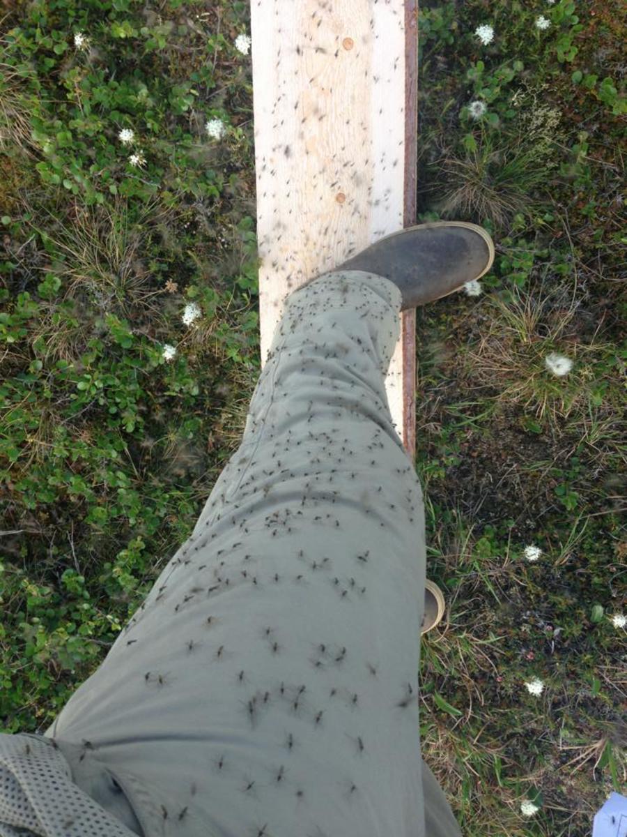 jesse krause's leg