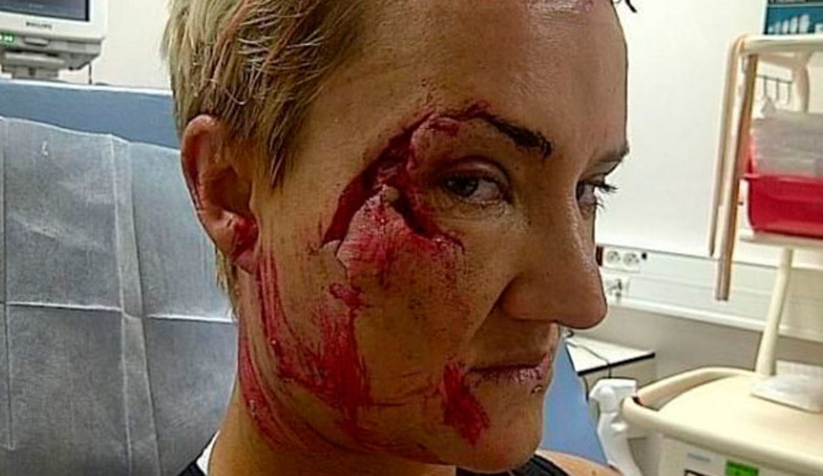 Keala posted this image on Facebook after her surgery.