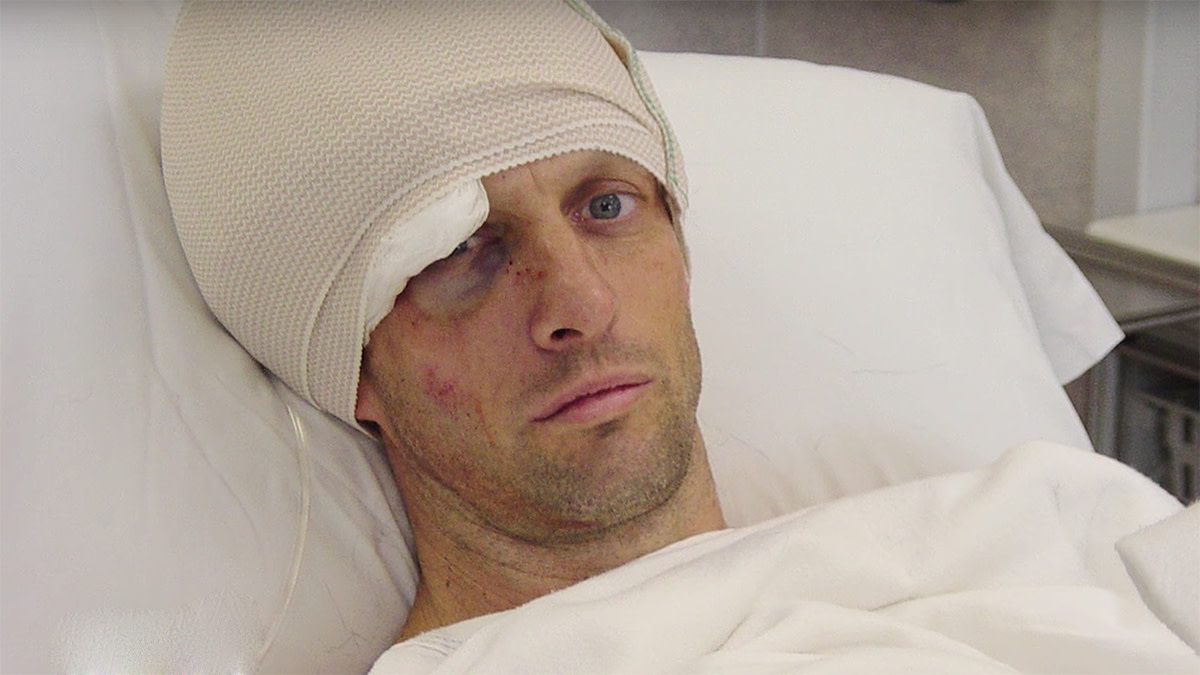 Tony Hawk in the hospital after the worst injury of his career. 