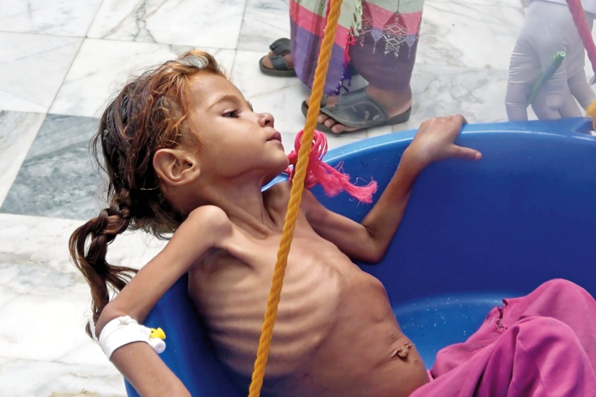 Ragehi’s photos of starving villagers, seen on this and the following page, sparked a U.N. investigation into why aid wasn’t reaching certain rural communities in Hajjah province, one of the hardest hit areas in Yemen’s ongoing civil war.