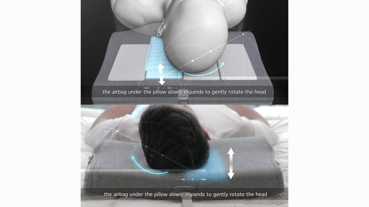 anti-snoring solution