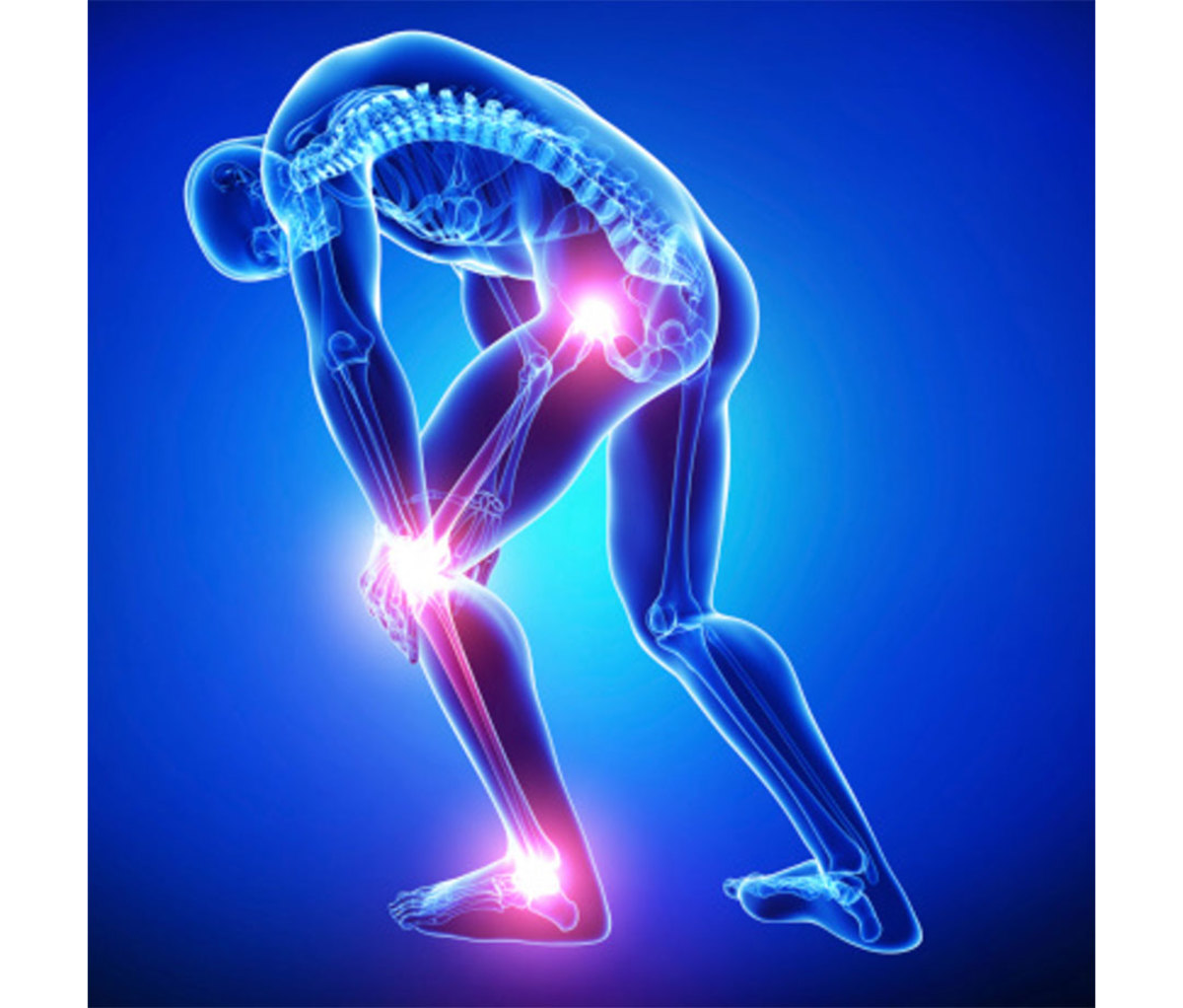 Joint Pain