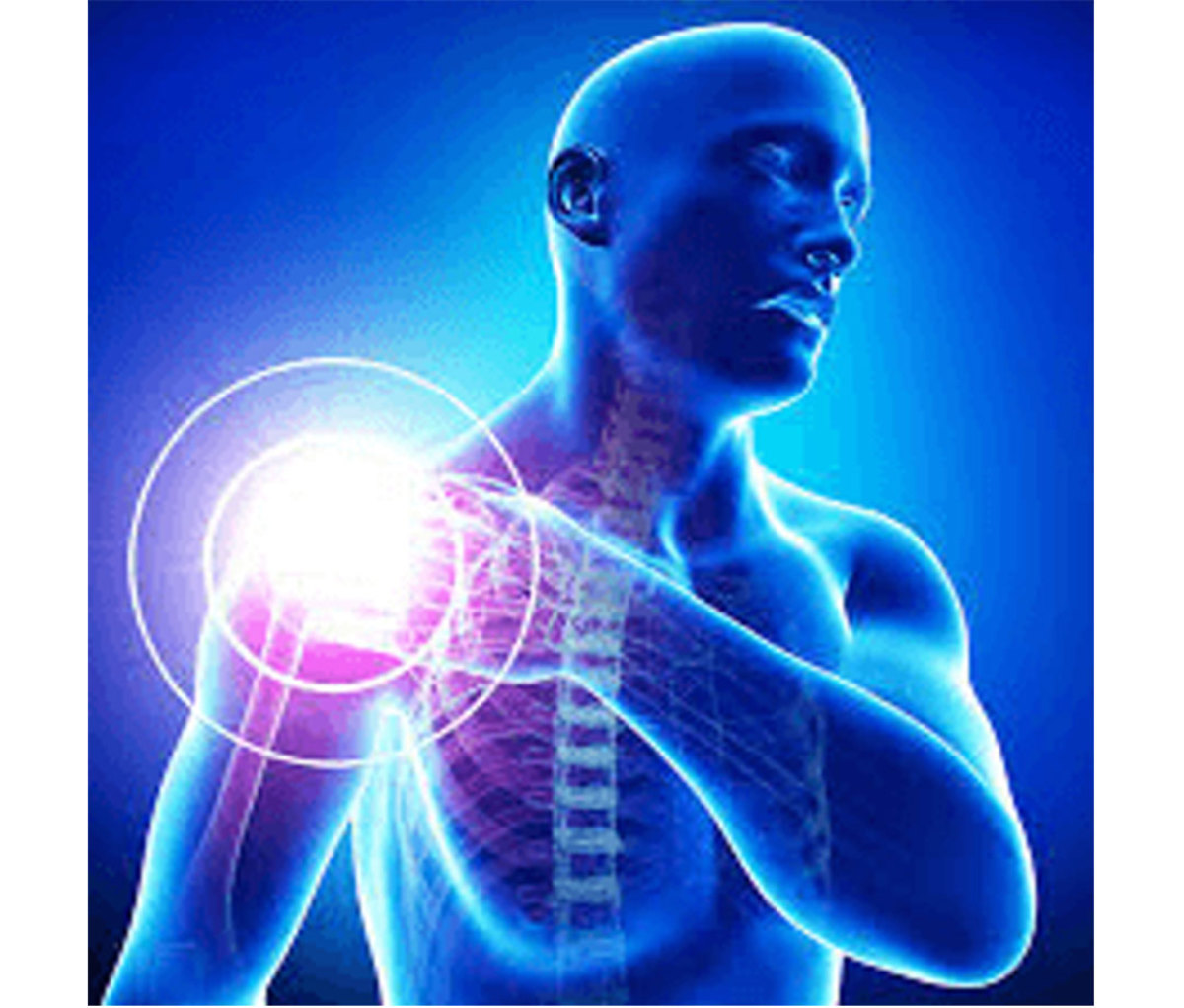 Joint Pain