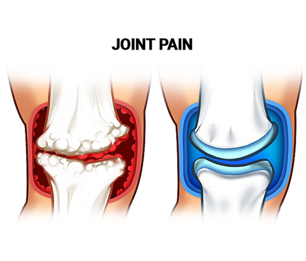 Joint Pain